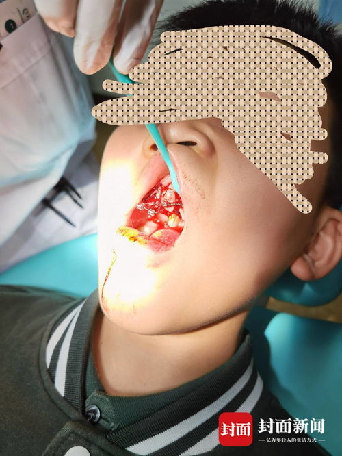 重慶特斯拉車主遭遇驚魂一幕 停車時(shí)車輛自動(dòng)加速撞墻，致孩子受傷